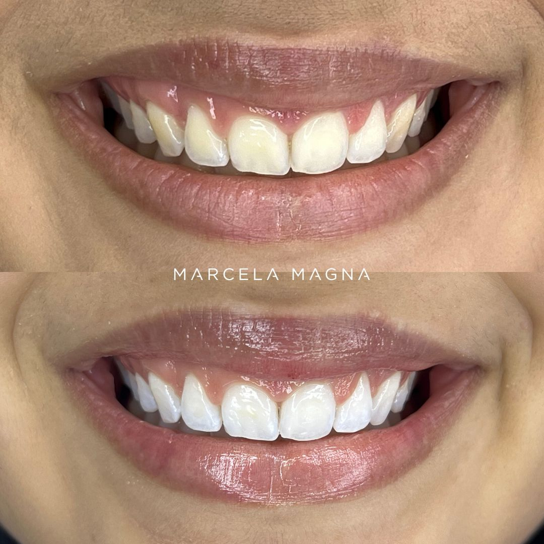 Marcela Magna - Dentista em Maceió (20)