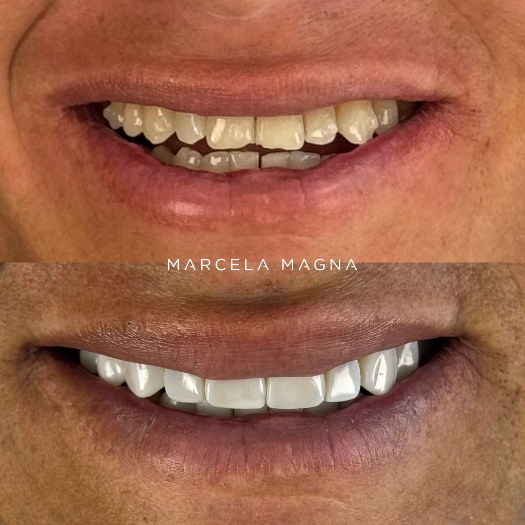 Marcela Magna - Dentista em Maceió (21)