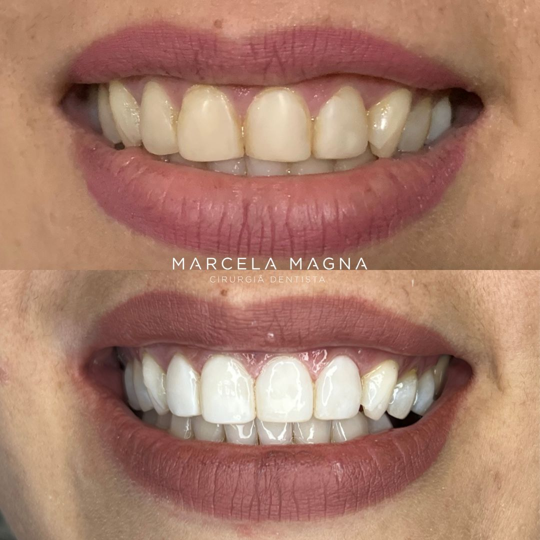 Marcela Magna - Dentista em Maceió (22)