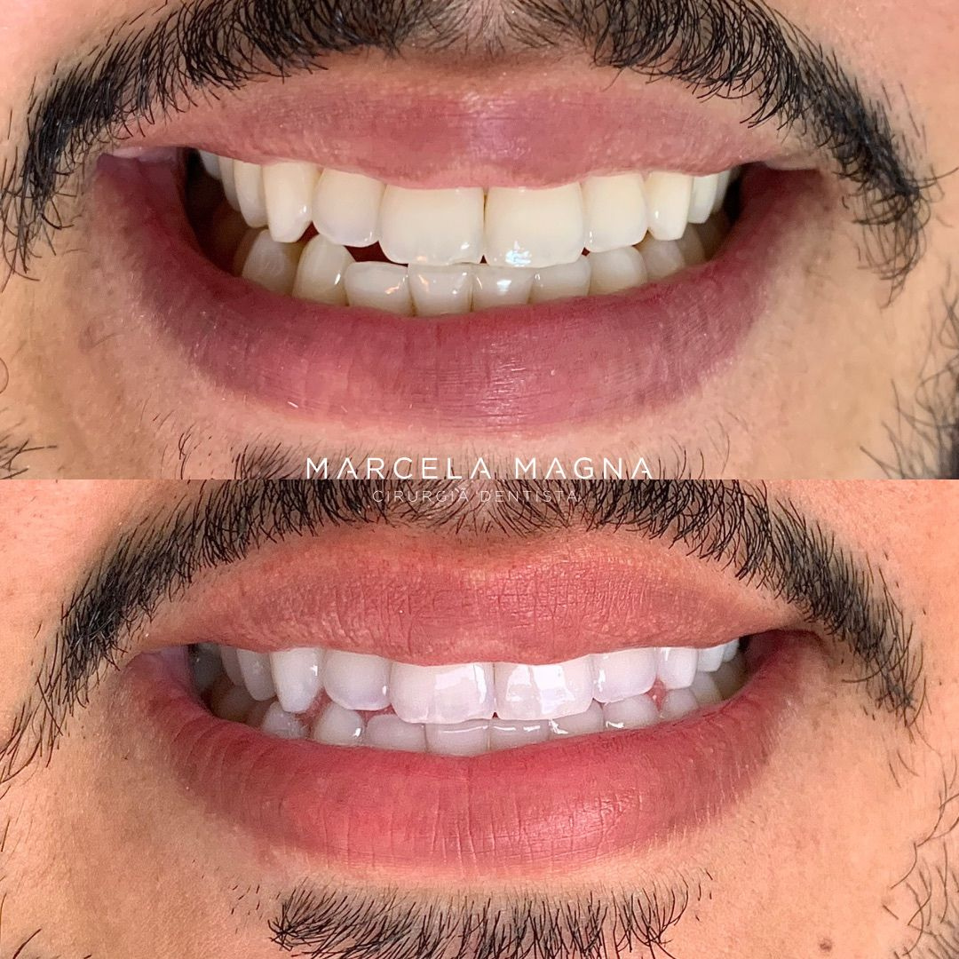Marcela Magna - Dentista em Maceió (23)
