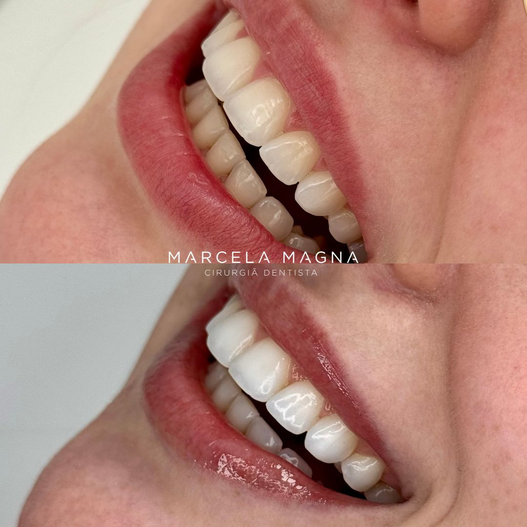 Marcela Magna - Dentista em Maceió (24)