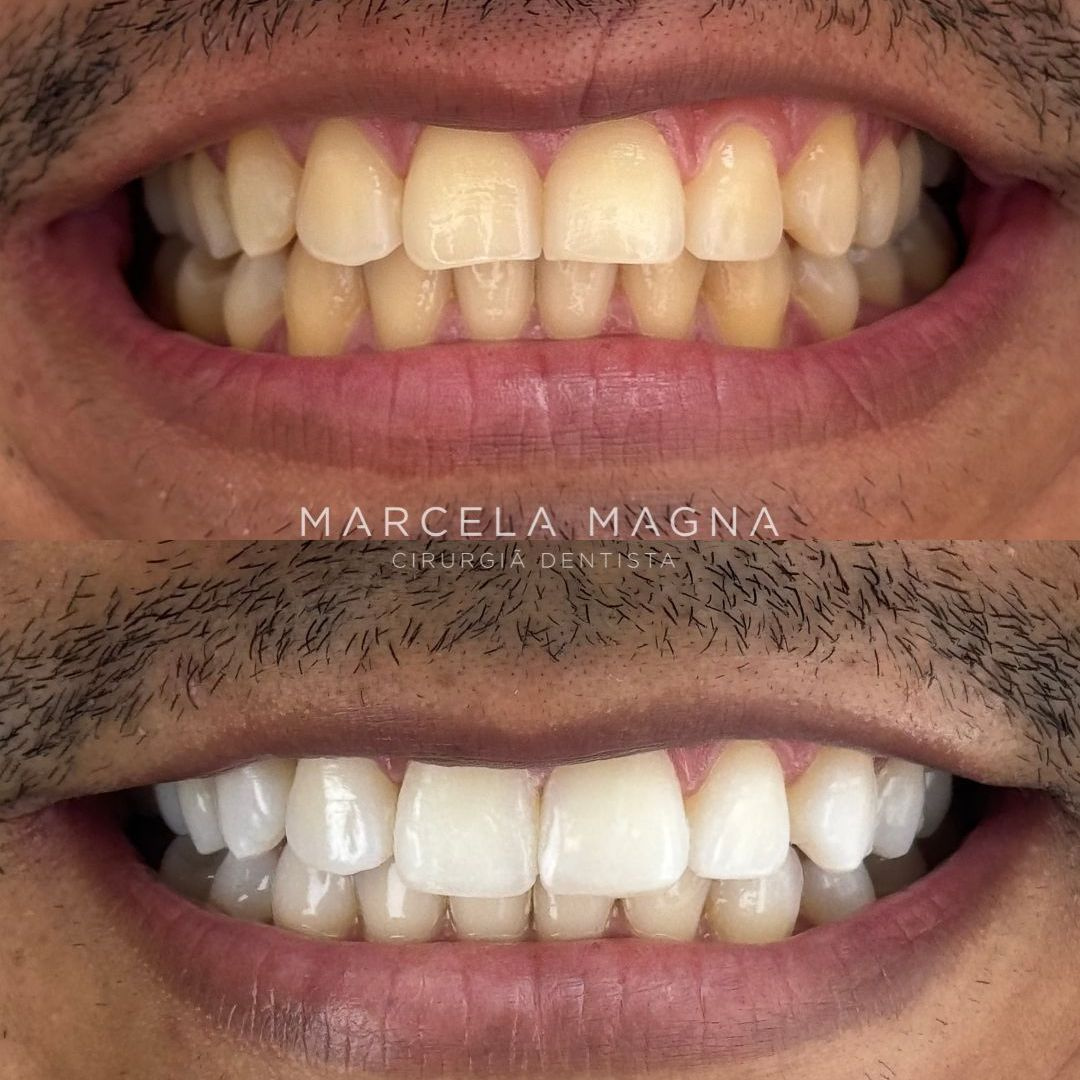Marcela Magna - Dentista em Maceió (25)