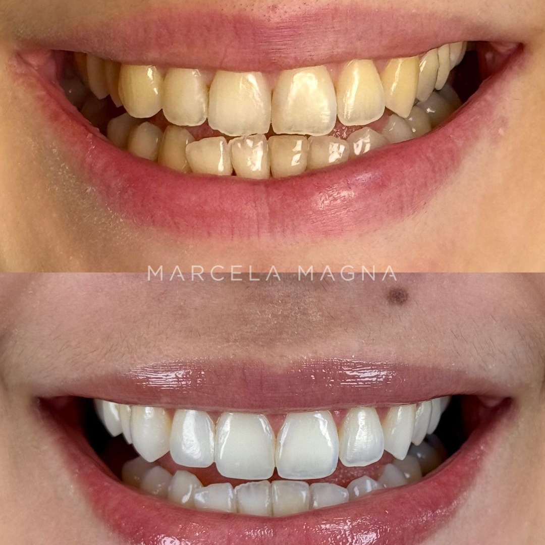 Marcela Magna - Dentista em Maceió (26)