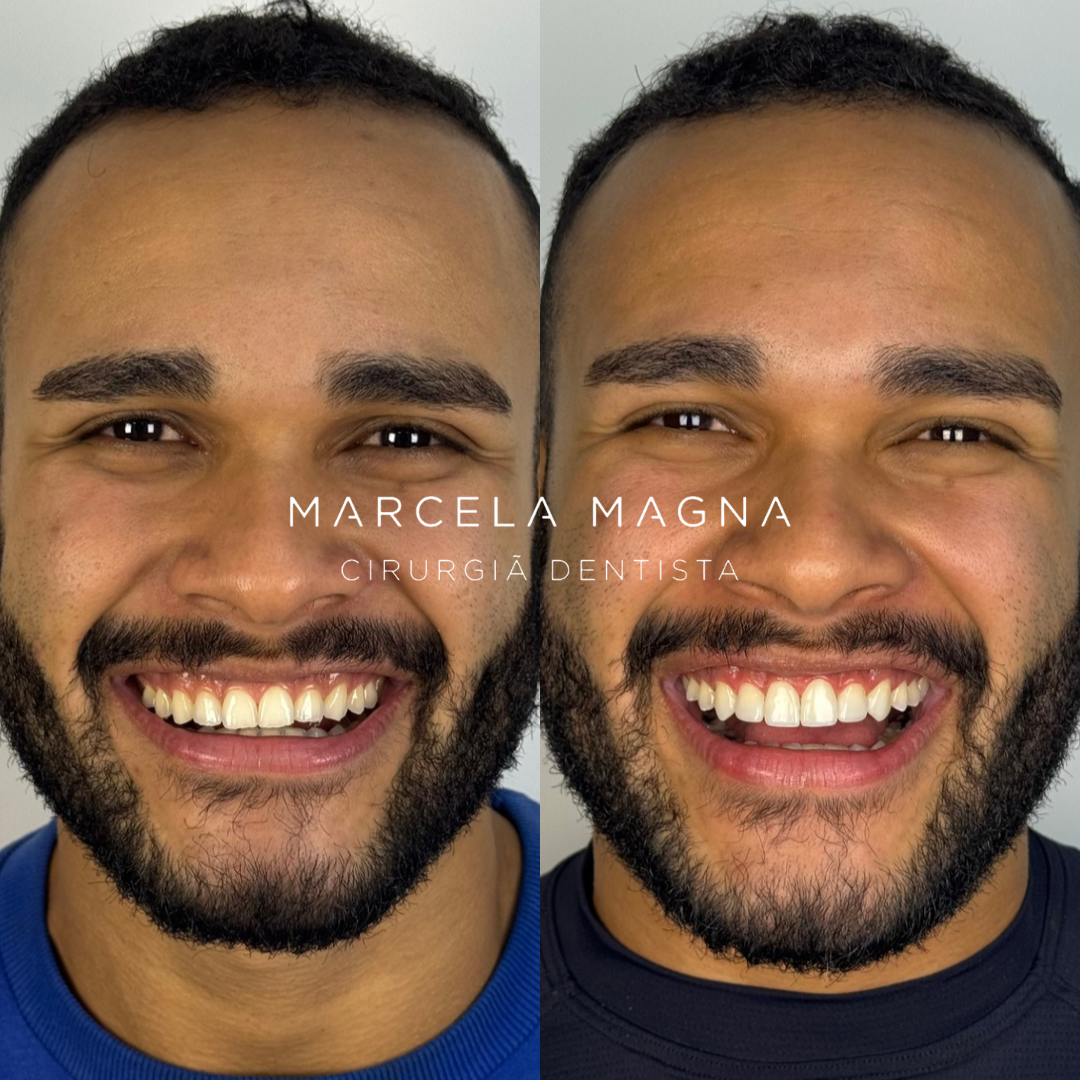 Marcela Magna - Dentista em Maceió (27)