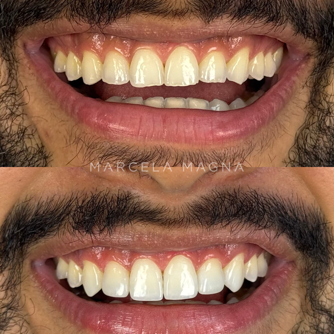 Marcela Magna - Dentista em Maceió (28)